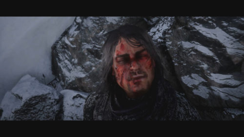 John after the wolf attack.